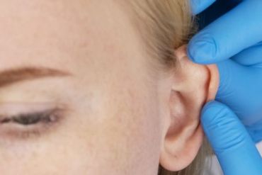 EAR LOBE REPAIR