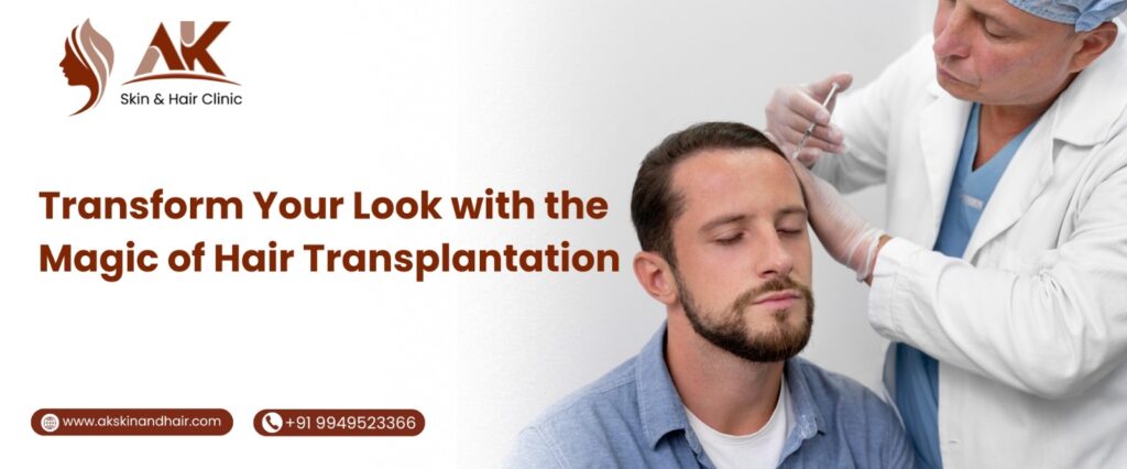 Hair Transpalantation